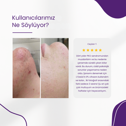 L'Oasis IPL - Evde Kalıcı ve Acısız Lazer Alternatifi